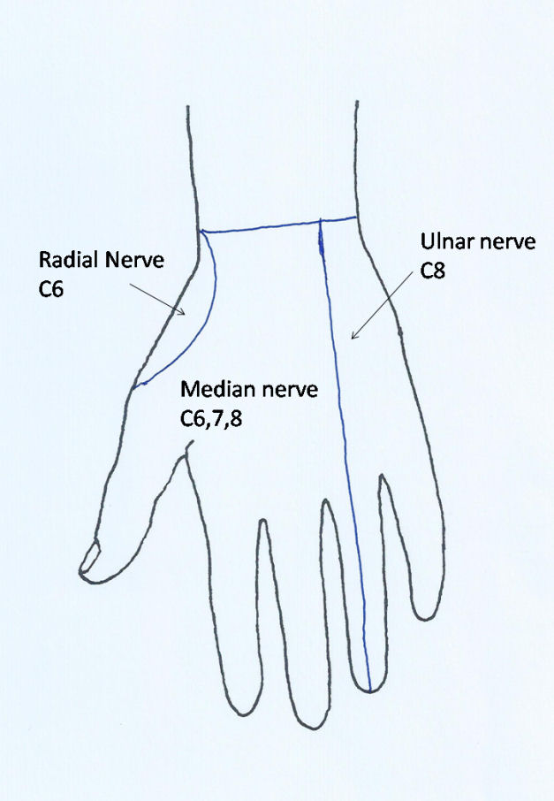Figure 7b: Sensory innervation of the palm of the hand