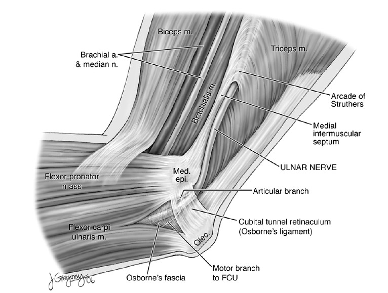 Figure 1: Anatomy of the ulnar nerve at the elbow (from:Polatsch DB, Melone CP, Jr., Beldner S, Incorvaia A. Ulnar nerve anatomy. Hand Clin 2007;23:283-289 with permission)