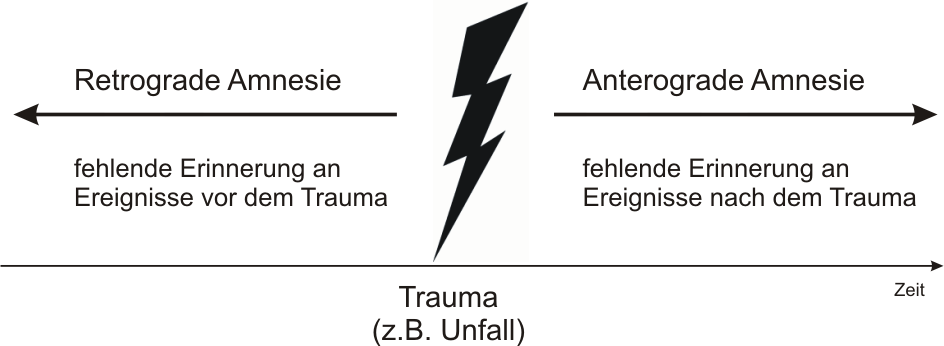 Abbildung 6: Formen der Amnesie (eigene Darstellung)