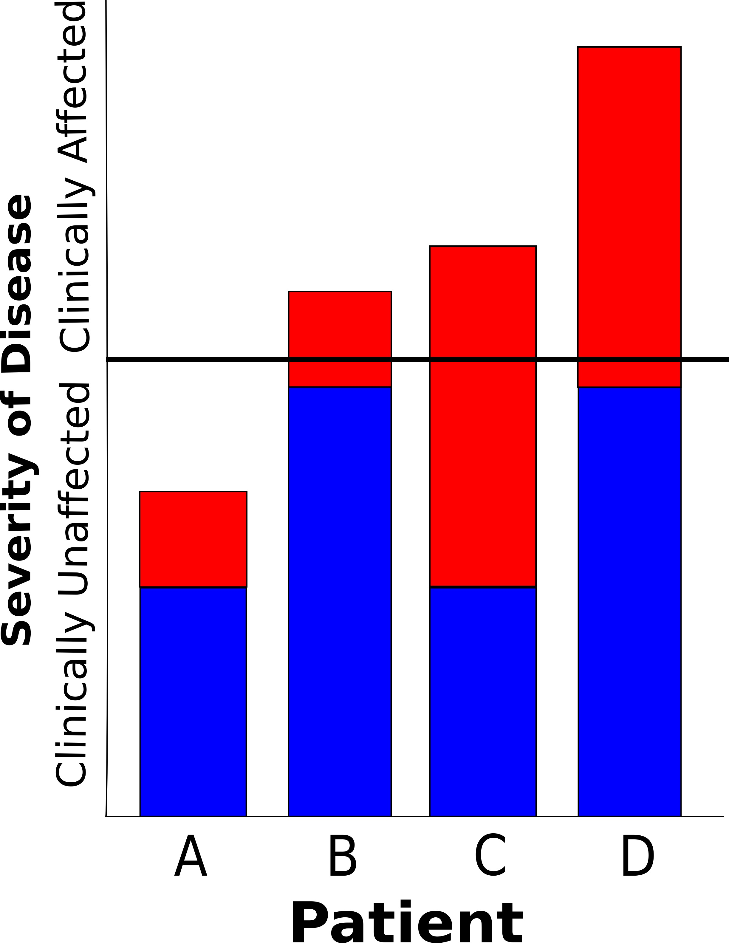 Figure 2: The threshold model of genetic predisposition to complex disease. Blue boxes represent genetic predisposition, and red boxes represent environmental predisposition. The horizontal black line represents a threshold, below which the individual is clinically unaffected. Patient A has a low genetic predisposition and low environmental exposure, and does not have the disease. Patient B has a large genetic predisposition, and a low environmental exposure is enough for them to exceed the threshold and be clinically affected. Patient C has a low genetic predisposition, but a large environmental exposure, and is also clinically affected. Finally, Patient D has a large genetic and environmental exposure, and is more severely affected.