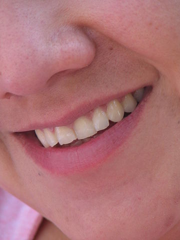 Abbildung 1: Lächeln von Ernesto Perales Soto aus Irapuato, Gto, Mexico (Die Abbildung ist von der CC-BY 4.0-Lizenzierung ausgenommen: Lizenz CC BY 2.0)