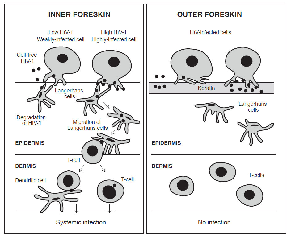 Figure 2: Current understanding of the foreskin-related mechanism of HIV-1 infection. This involves formation of apical viral synapses between cells highly infected with HIV and dendrites of Langerhans cells. Local HIV budding and HIV capture ensues, resulting in cell-to-cell transfer of HIV (black dots) from infected cells to dendrites of Langerhans cells, a process that takes 1 hour. A reduction in CCL20/MIP-3-alpha secretion occurs as Langerhans cells migrate to the basal layers of the epidermis within 4 hours, where they transfer their HIV cargo to T-cells. At 4 hours T-cells are recruited from the dermis into the epidermis as a result of increased CCL5/RANTES secretion, so fuelling the formation of Langerhans cell-T-cell conjugates. The T-cells can then also infect dendritic cells. In contrast, cell-free HIV particles or HIV in cells with a low viral load are taken up by Langerhans cells and degraded.